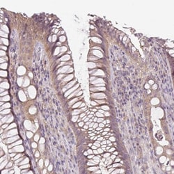 UBL3 Antibody, Novus Biologicals 25 &mu;L, Unlabeled:Antibodies, Polyclonal